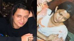 Kangana Ranaut's sister Rangoli Chandel reveals painful details about her Acid Attack