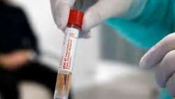 Congress MLA in Gujarat tests positive for coronavirus