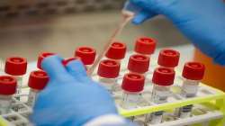 Antibody tests may help detect COVID-19 infection if used at right time: Scientists