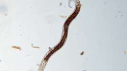 Doctors found 1.5 inch-long worm in woman's tonsils as she complained of sore throat