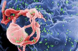 In a first, patient beats HIV infection; cell analysis show no traces of virus