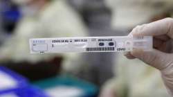 770 students test coronavirus positive at UK university