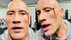 Dwayne Johnson injures face while working out