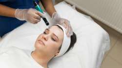 Microneedling