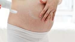 Pregnancy stretch marks