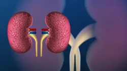 kidney cancer