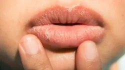 dry lips