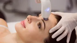 laser treatment