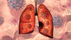 Know importance of early diagnosis for lungs