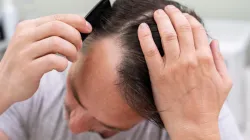  Foolproof tips to combat hair fall