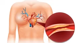 Know what happens to your body when you have high cholesterol