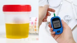 diabetes urine symptoms