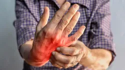 Debunking 5 common myths about Rheumatoid Arthritis