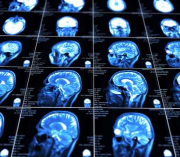 New technology could deliver drugs to brain injuries
