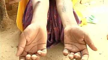 Woman gangraped by husband, in-laws; tattooed with expletives over dowry