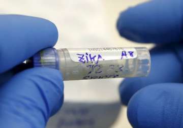 Zika virus antibodies identified in mice