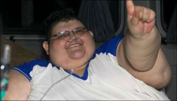 World's most obese man, weighing 500 kg