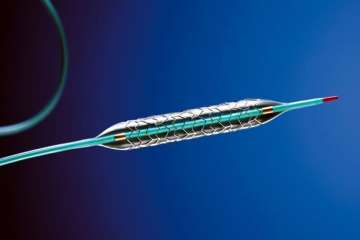 Prior to NPPA cap, stent prices varied in the range of Rs 24,000 to Rs 2 lakh