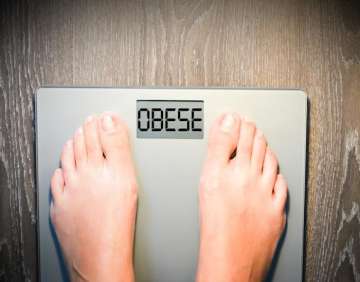 Warning! Being overweight can lead to kidney failure 