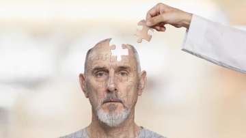 New Alzheimer's test can predict the age of disease onset 