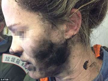Female passenger suffers severe injuries after headphones explode mid-flight 