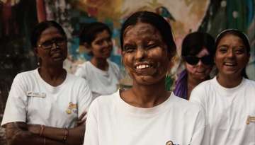 Acid attack victims to find a career in tattoo art