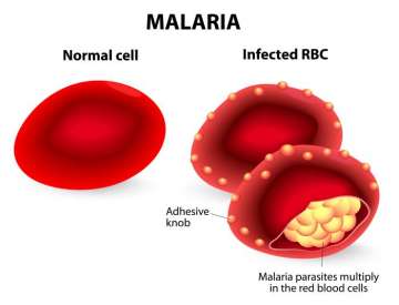 malaria