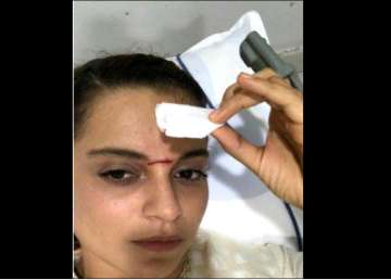 Kangana Ranaut head injury