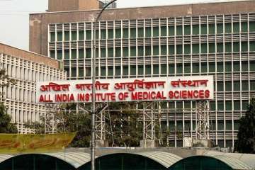 AIIMS marathon surgery conjoined twins