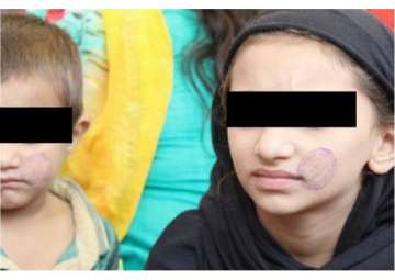 Two minors stamped entry seal on faces on visit to Bhopal Central Jail 