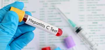 Increased opioid use causes HIV Hepatitis C cases