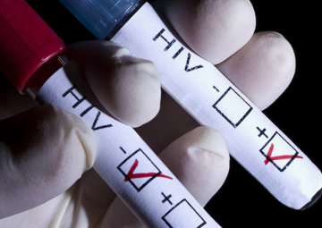 14,632 HIV positives identified in Mizoram 