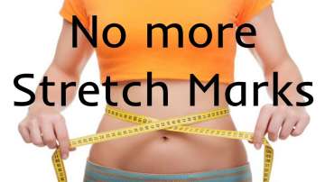 Want to get rid of stretch marks? Follow these easy four steps