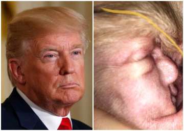 donald trump dog ear