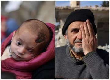 Left- Baby Karim, Right- A man covering his left eye in support of Karim