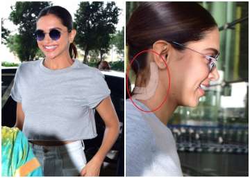 Did Deepika Padukone injure her neck while working out? See pics