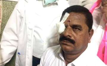 Telangana Assembly witnesses ugly brawl, Legislative Council Chairman hit by microphone