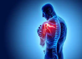 Suffering from shoulder instability? Try arthroscopy