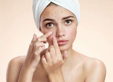 Latest Beauty News: Find a vaccine which offer treatment for acne