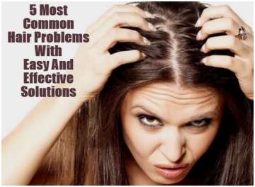 5 most common hair problems with easy and effective solutions