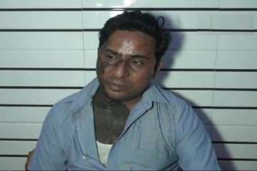 Urdu poet Hashim Firozabadi attacked with acid in UP