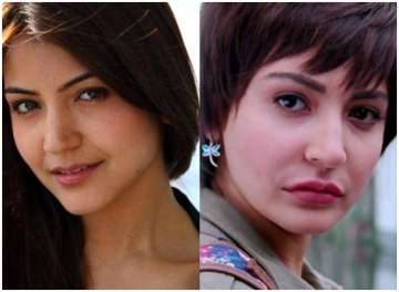 5 lip fillers do's and don'ts; see the pictures of Indian actresses who tried puffed up lips