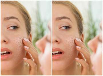 From dry to oily skin, here's your ultimate skin care guide for different skin types in winter