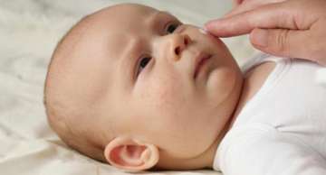 Manage dry and itchy skin in babies