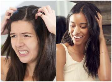 Beauty Tips & Tricks | 6 easy and effective hair care solutions for itchy, dry scalp