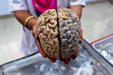 Chimp 'mini-brains' help decode how humans got big brains