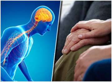  Know what Parkinson disease is all about; Researchers developing new therapy to treat PD