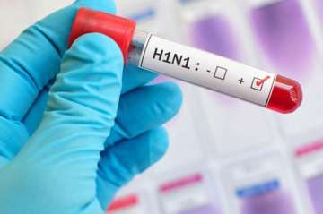 Swine Flu: Here's to know everything about H1n1 infection; Definition, symptoms and signs