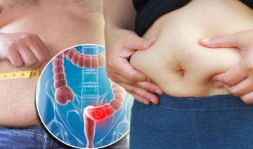 Fungus linked to dandruff may worsen bowel disease, says study