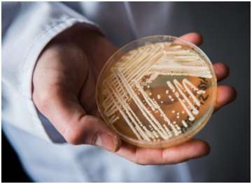Health update: No clinical evidence of deadly fungus Candida auris in India yet